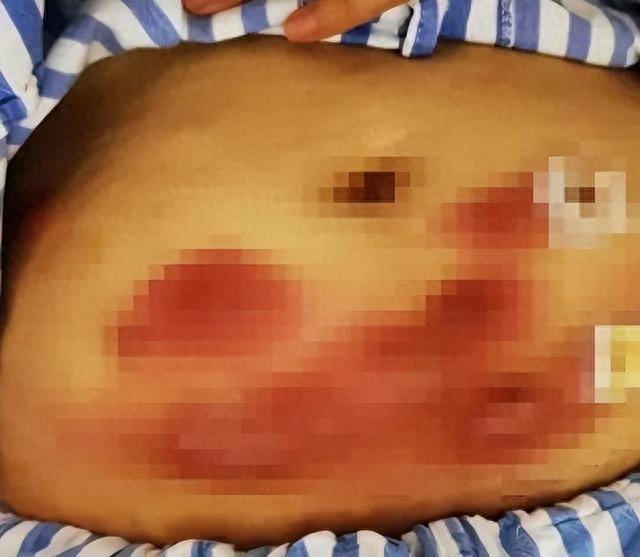 25 岁女主播轻信溶脂针，快速瘦身背后的惊人真相  第1张