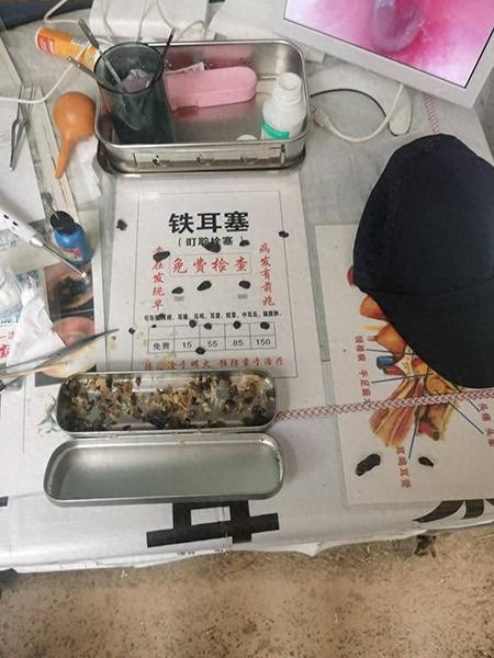 采耳摊惊现假耳屎骗局，市民花数千元体验后报警，警方迅速破案