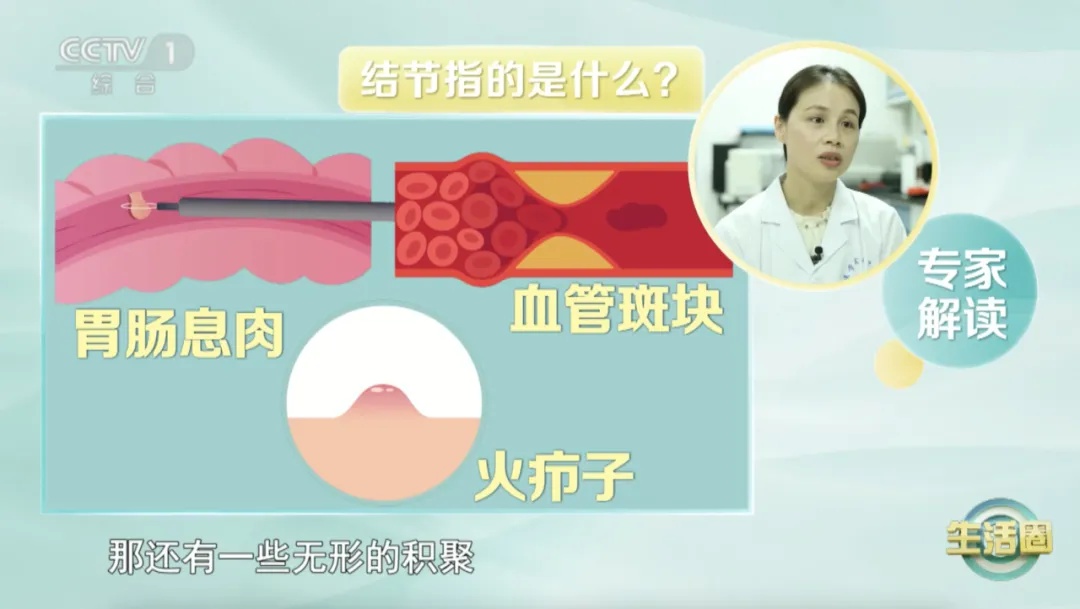 山楂、芋头、蒲公英真的能消散结节？医生揭秘天然散结菜的真相  第5张