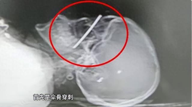 加装遮阳伞的电动自行车，竟成伤人凶器  第1张