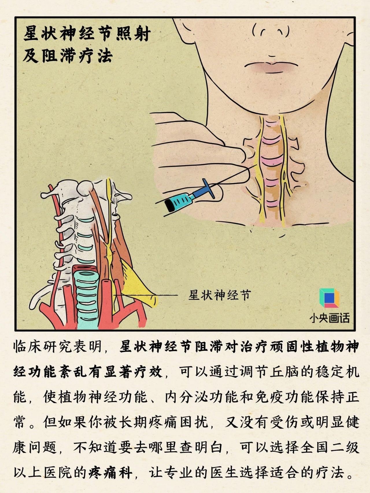 警惕！慢性疼痛可能导致情绪失控，你还在忽视吗？  第7张