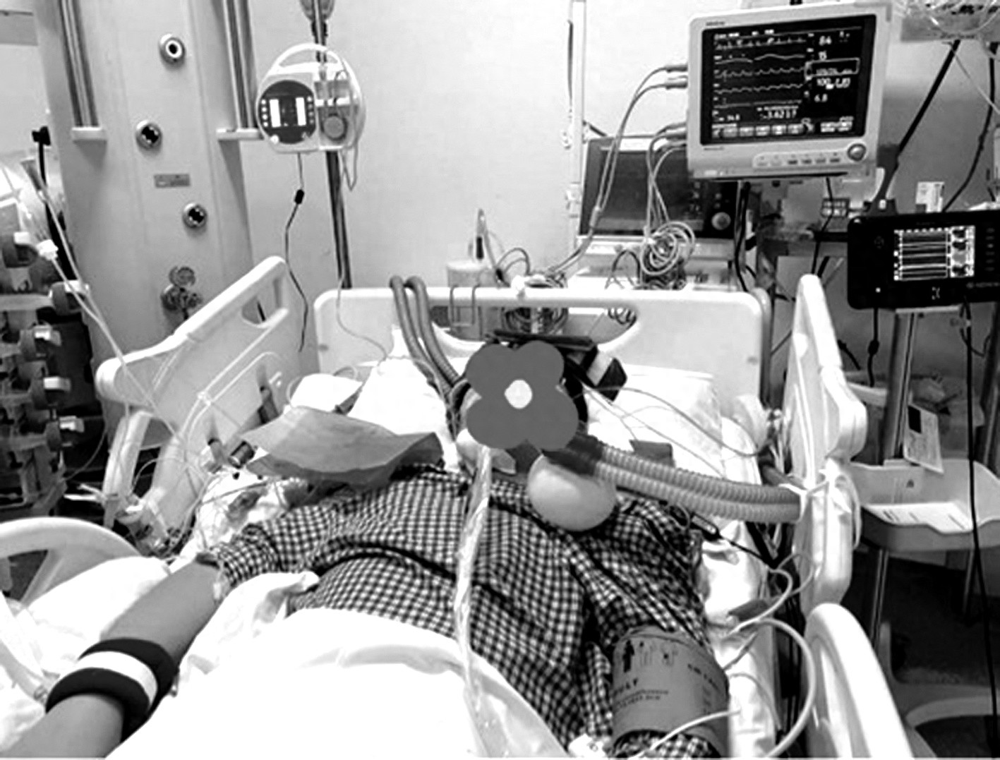 20岁大学生因盲目减肥心脏骤停，40分钟生死抢救揭示健康真相  第1张