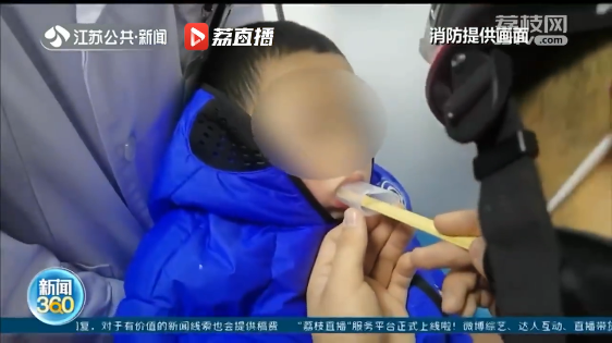网红糖果竟成凶器，4 岁男童被夹嘴 40 分钟  第3张