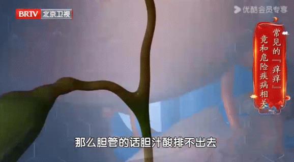 谁说痒痒只是小事？手脚发痒可能是血糖超标的警报  第2张
