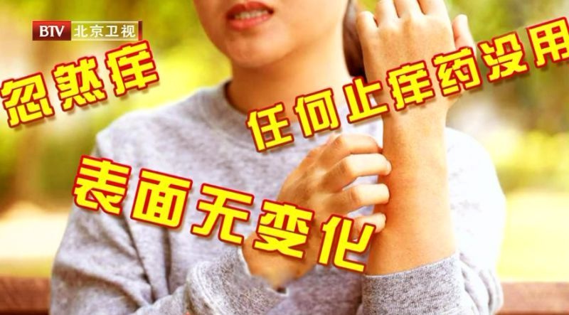 谁说痒痒只是小事？手脚发痒可能是血糖超标的警报  第4张