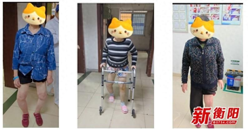 免费赠送膝关节置换假体公益活动，让患者重获健康  第1张