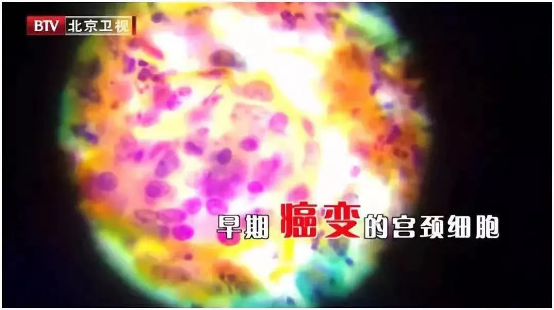 炎症竟是身体的超能力？一文带你全面了解炎症的好坏  第3张