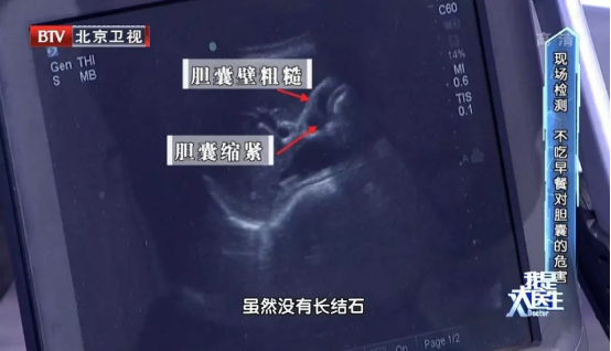 30 岁妈妈被最强癌王伪装成胃炎，儿子的呼唤能否唤醒她？  第5张