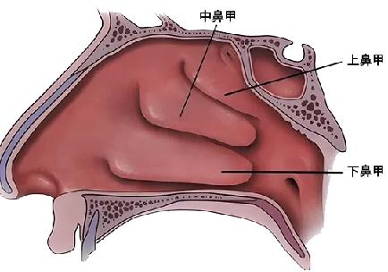 揭秘鼻甲肥大：你不知道的鼻腔健康隐患，如何影响你的生活质量？  第1张