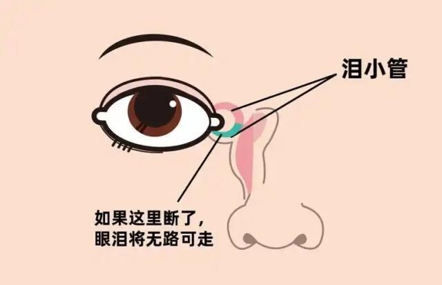 7岁女童街头玩耍突遭宠物狗袭击，泪小管断裂，紧急手术成功挽救视力  第3张