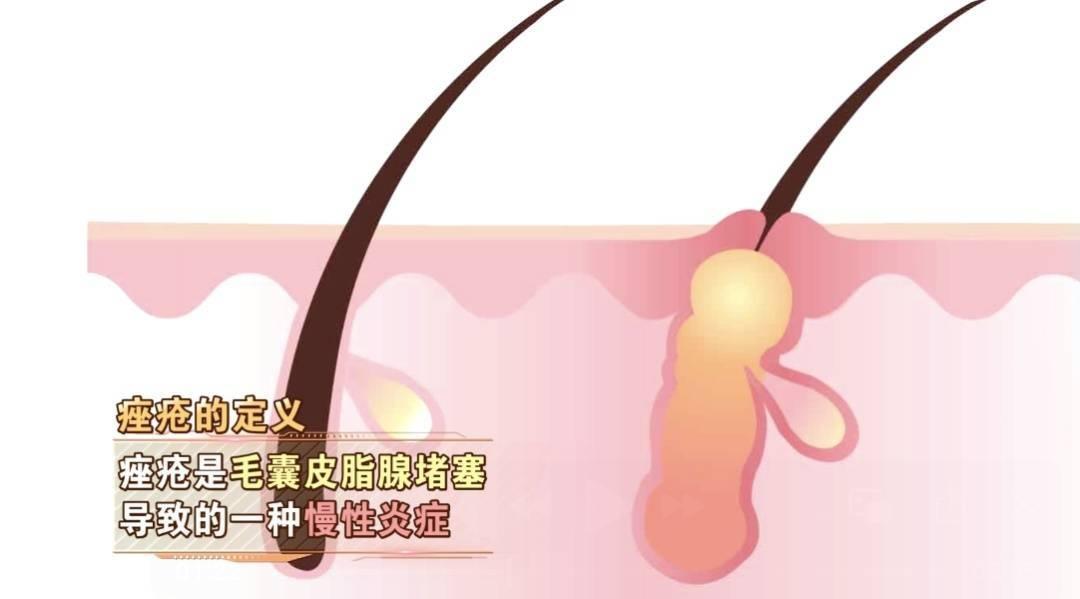 秋燥来袭！口干舌燥、皮肤干燥、痤疮频发，你中招了吗？  第3张