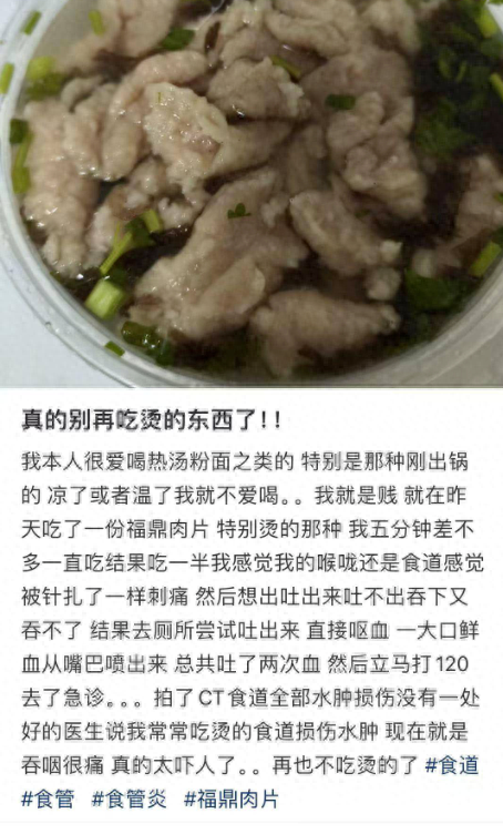吃一碗很烫的福鼎肉片，竟导致呕血、食道水肿