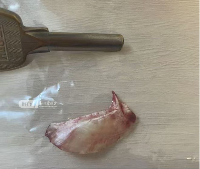 一块鱼刺差点夺命！老司机吃鱼卡喉，这些土方法竟暗藏杀机  第2张