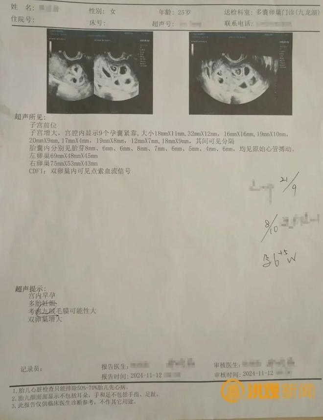 女子注射促排卵针后竟怀上 9 胞胎  第2张