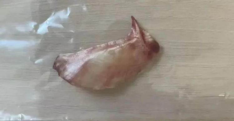 一根鱼刺差点夺命！老司机吃鱼卡喉，这些土方法竟暗藏杀机  第2张