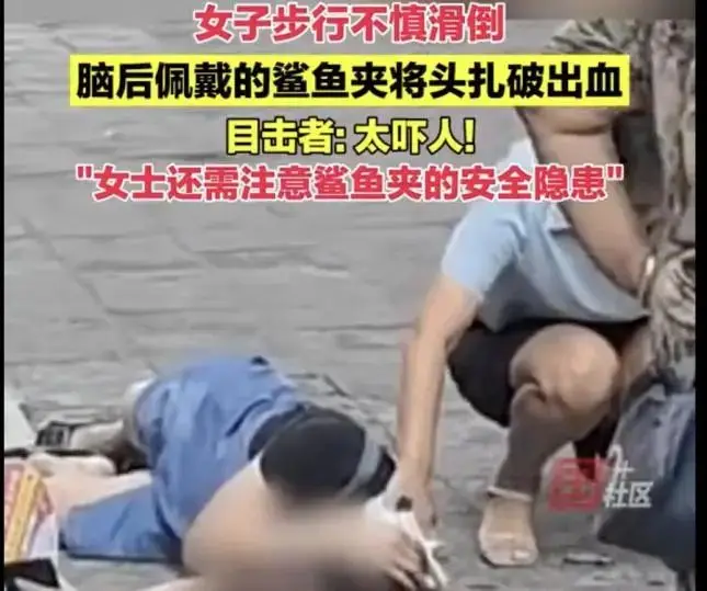 痛心！28 岁女孩戴鲨鱼夹摔成植物人，男友不离不弃：我会一直等她醒来  第5张