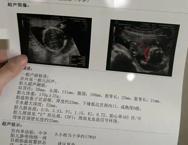 20 岁女孩代孕流产后被赶出宿舍，仅获千元补助，她的未来何去何从？  第2张
