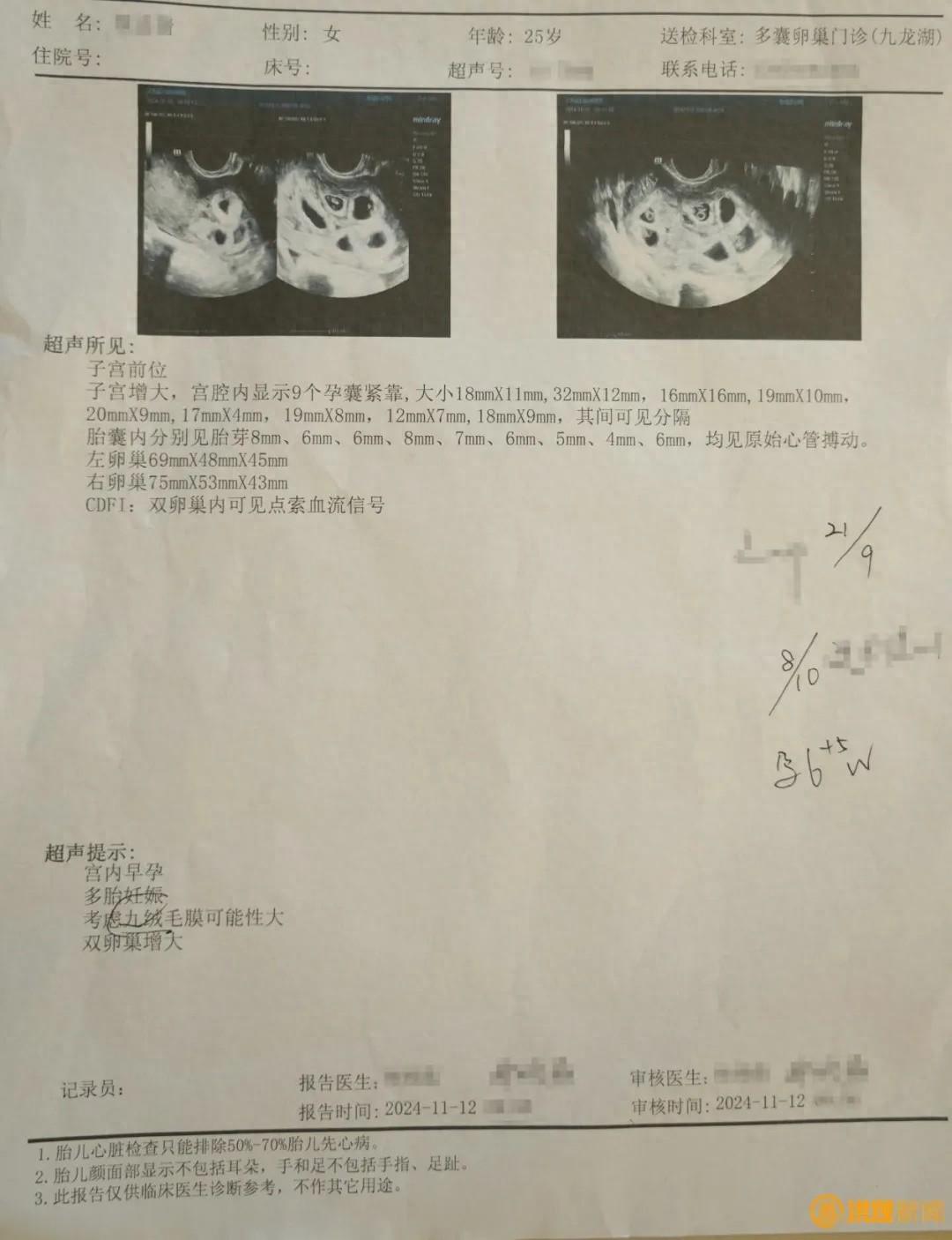 25 岁女子注射促排卵针，竟怀上九胞胎！这是怎么做到的？