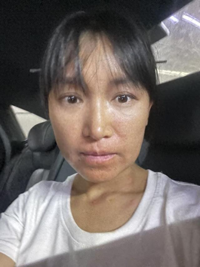 痛并快乐着！李子柒因漆艺过敏，仍坚持展现中国非遗之美