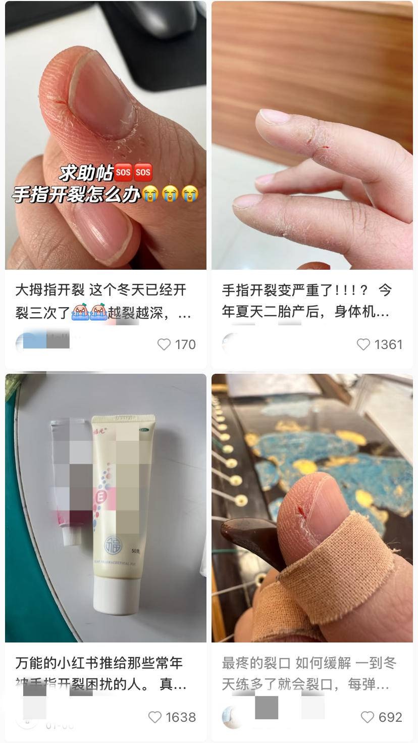冬季皮肤皲裂困扰无数人，专家揭秘：这样做才能彻底解决  第2张
