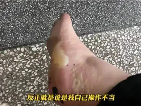 凌晨惊魂！电热毯自燃引发火灾，情侣17楼窗沿待援，生命悬于一线  第1张