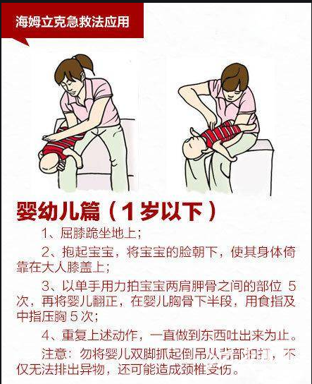 3 岁儿童误吞硬币，重庆医科大学附属儿童医院深夜紧急救援