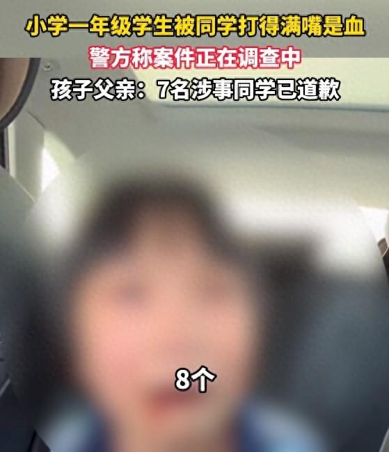 山西晋中一小学 8 名同学霸凌 1 名女孩致满嘴是血，你怎么看？  第1张