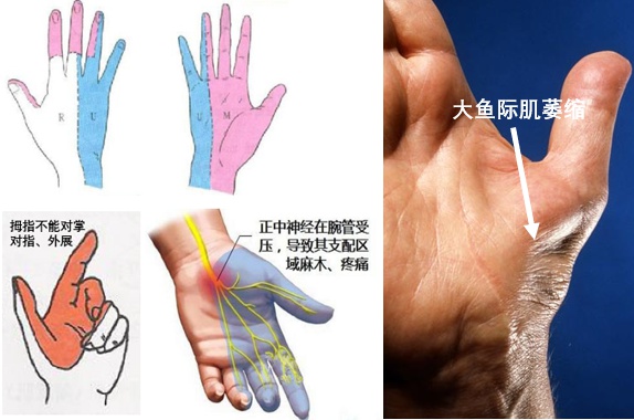 2025年职业病分类大调整！新增肌肉骨骼疾病和精神障碍，你的工作安全吗？  第2张