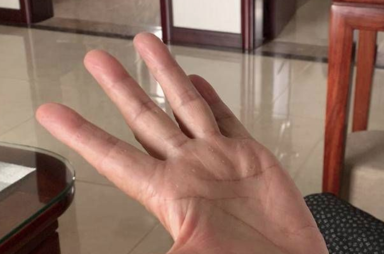 佛手瓜营养丰富，富含硒和 B 族维生素，堪称蔬菜中的硒库  第2张