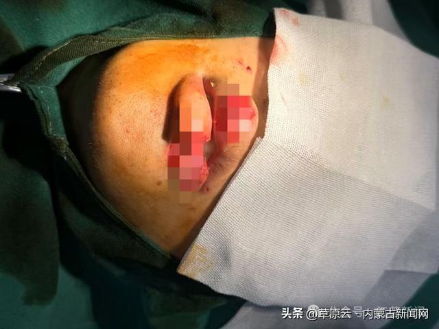 男子与宠物狗玩亲亲，竟被咬掉半个嘴唇  第2张