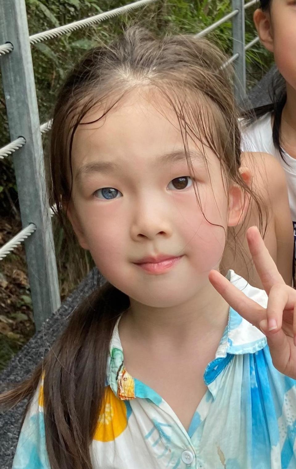 6岁女孩天生异瞳，一只黑一只蓝，妈妈曾担心被嘲笑，结果却出人意料  第2张
