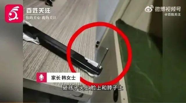 17 岁男孩遭多名学生持钉棍围殴，校园暴力何时休？  第2张