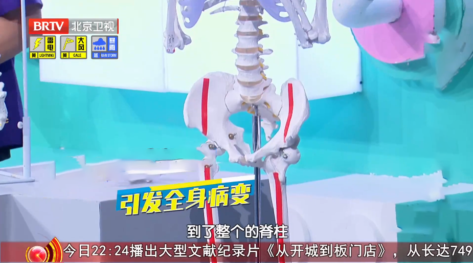 女子脚底疼痛难忍，罪魁祸首竟是它！医生：继续发展后果不堪设想  第2张