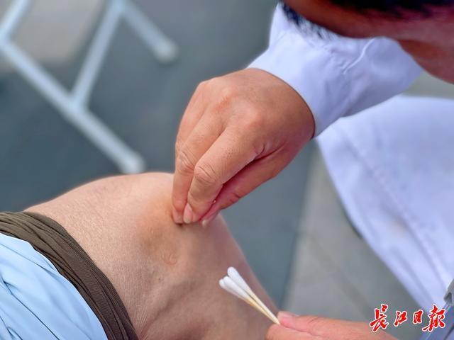 针灸点穴真有这么神奇？十几秒就能缓解疼痛  第3张