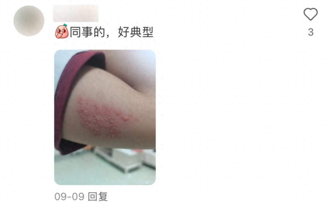 警惕！疱疹病毒潜伏身体，抵抗力低易复发，你还敢掉以轻心吗？