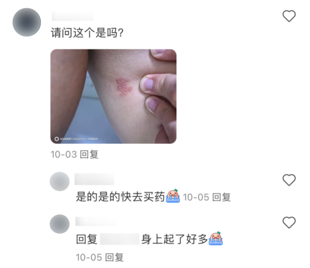 警惕！疱疹病毒潜伏身体，抵抗力低易复发，你还敢掉以轻心吗？  第2张