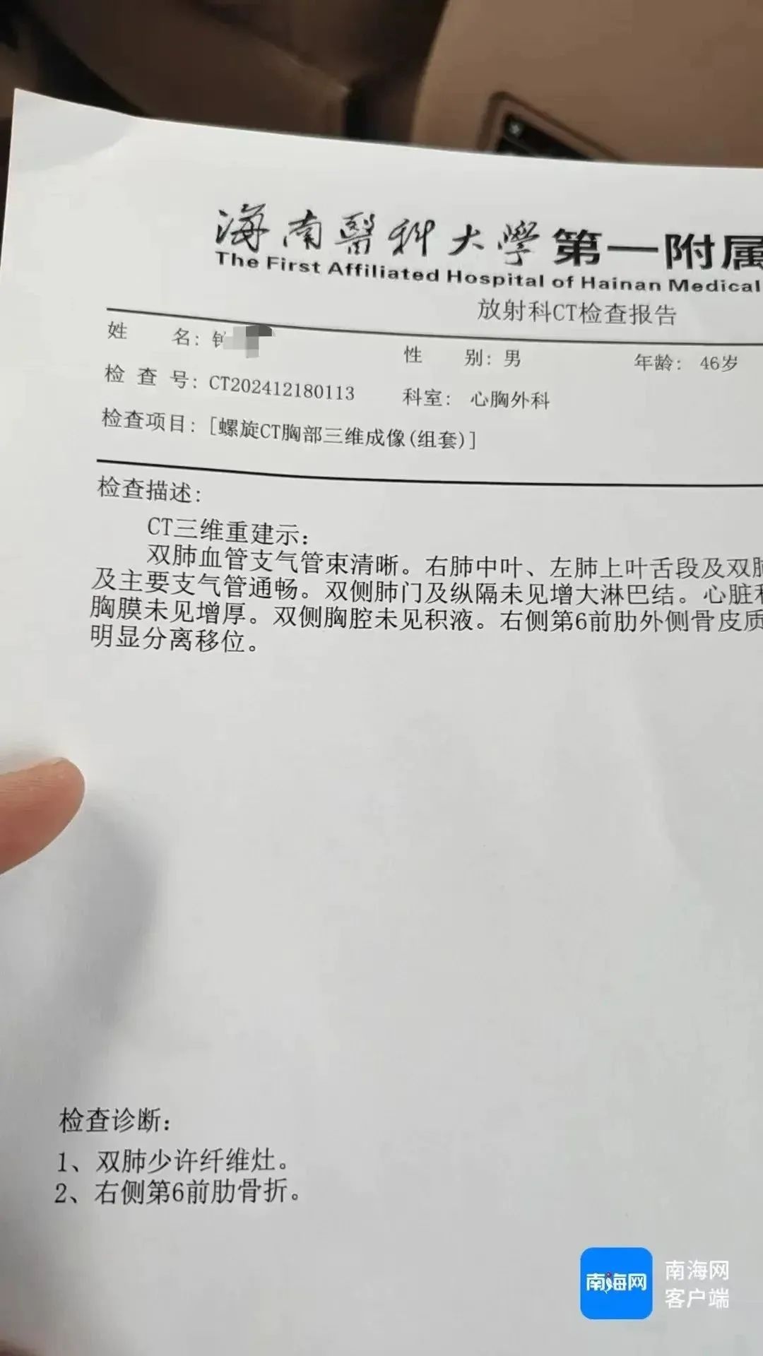 大巴司机深夜遭乘客暴打，肋骨骨折！背后真相令人  第3张