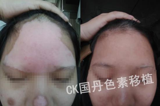 女人的美丽杀手，你知道吗？  第2张