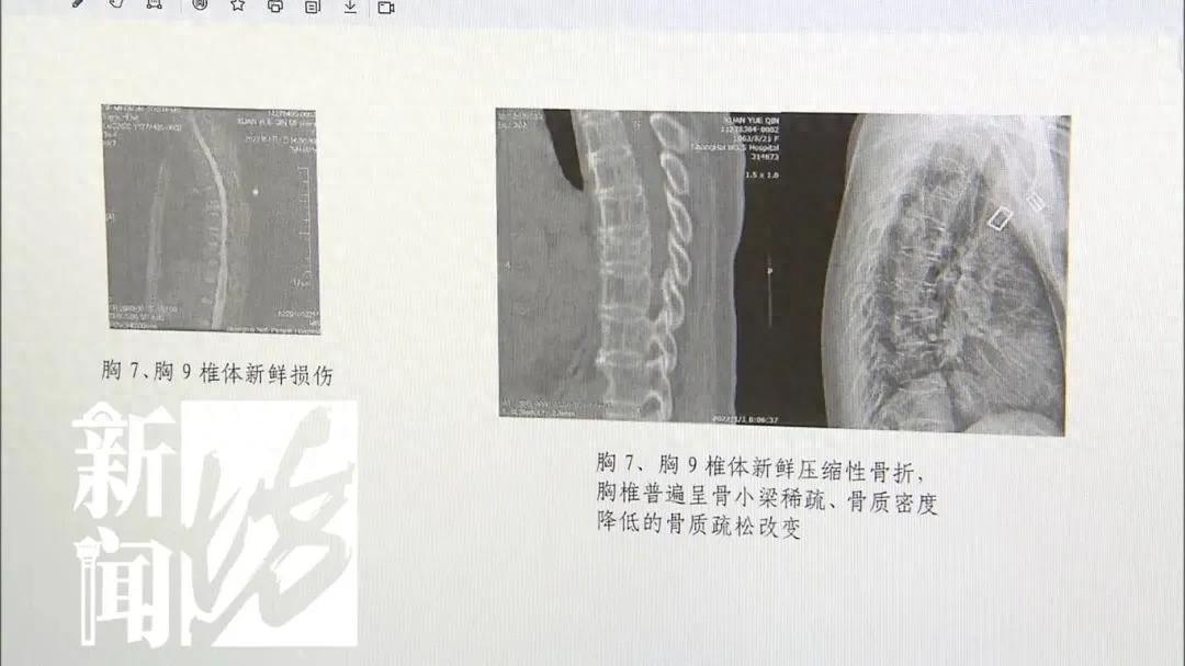 救护车颠簸致患者家属九级伤残，52 万赔偿责任谁来担？