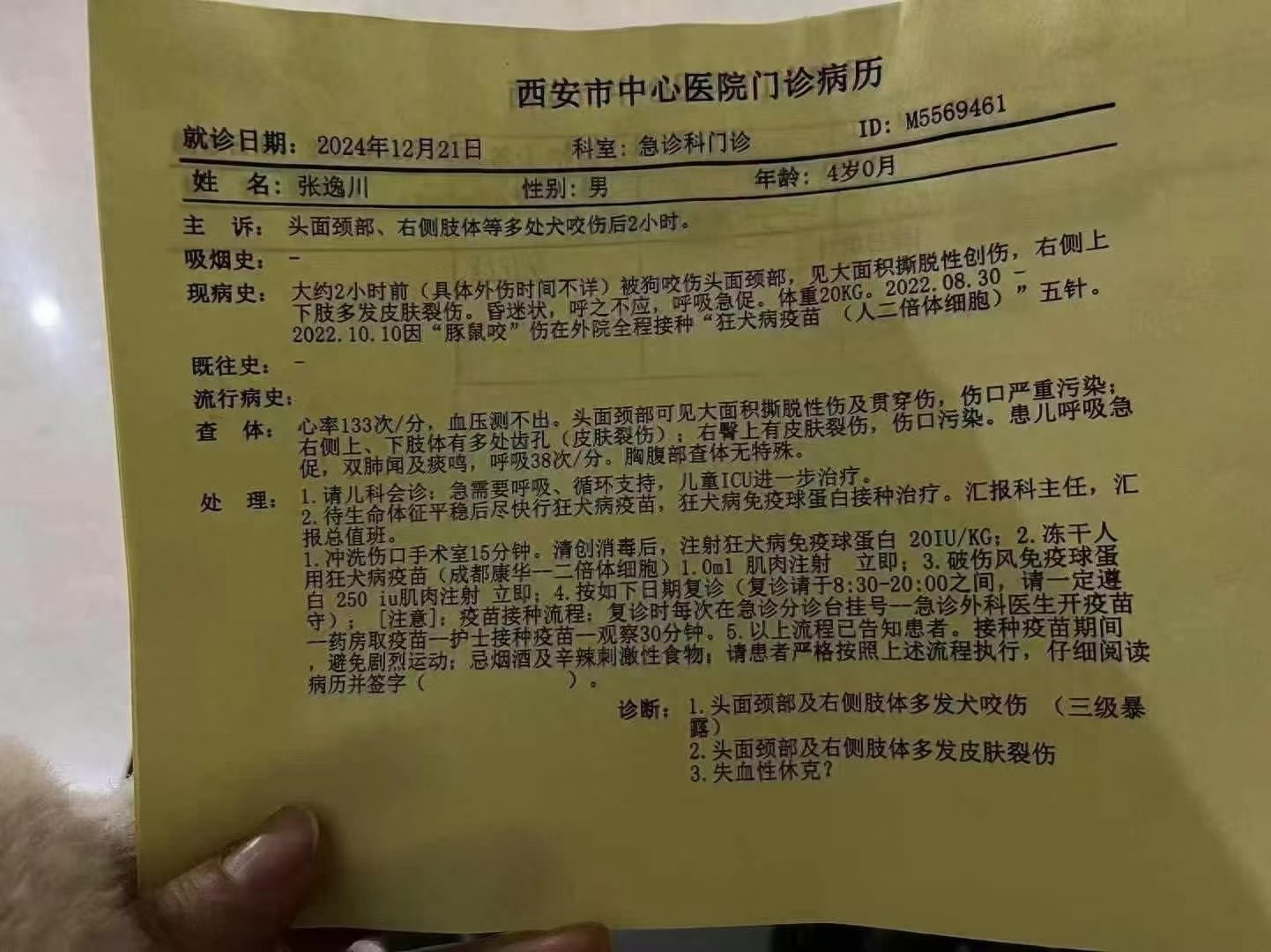 4岁男童被恶犬袭击昏迷，ICU抢救未脱离危险，警方调查犬只来源