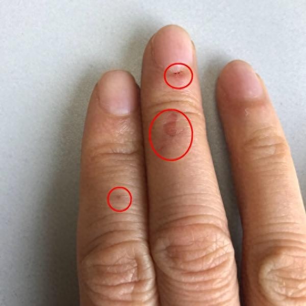 惊险瞬间！护士长用手指救下5岁抽搐男孩，生死时速的抢救现场曝光