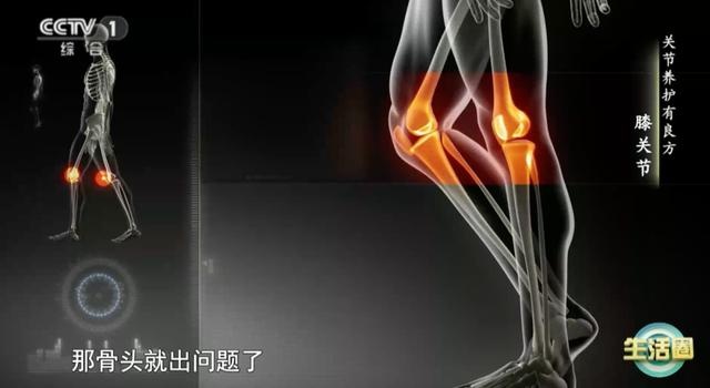 膝盖疼痛难忍？中医专家教你科学预防和缓解膝关节疼痛，告别老寒腿  第2张
