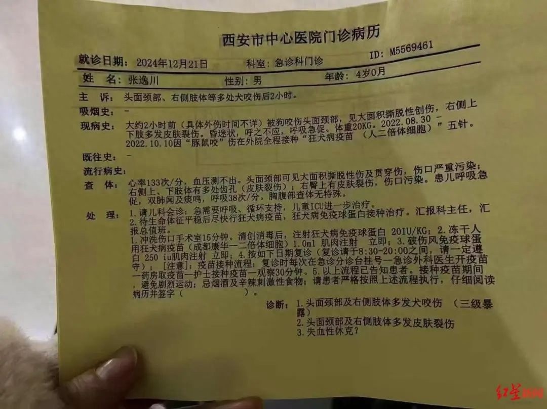 4岁男童村口玩耍突遭恶犬袭击，满脸鲜血昏迷不醒，家人紧急求救