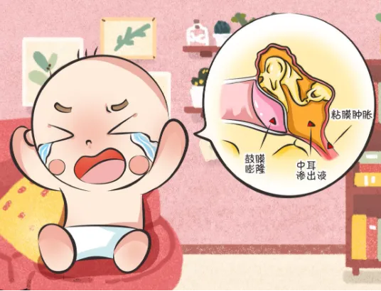换季时孩子耳朵疼，家长们注意了！这可能是急性中耳炎  第2张