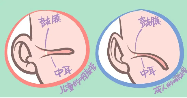 换季时孩子耳朵疼，家长们注意了！这可能是急性中耳炎  第3张