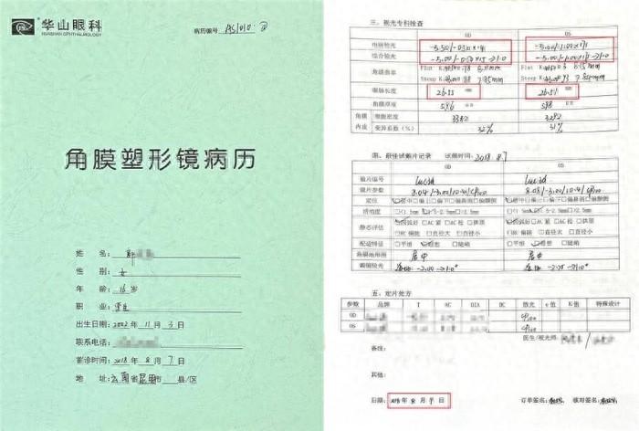 戴了六年角膜塑形镜还能做近视手术？22 岁小郭打破常规认知