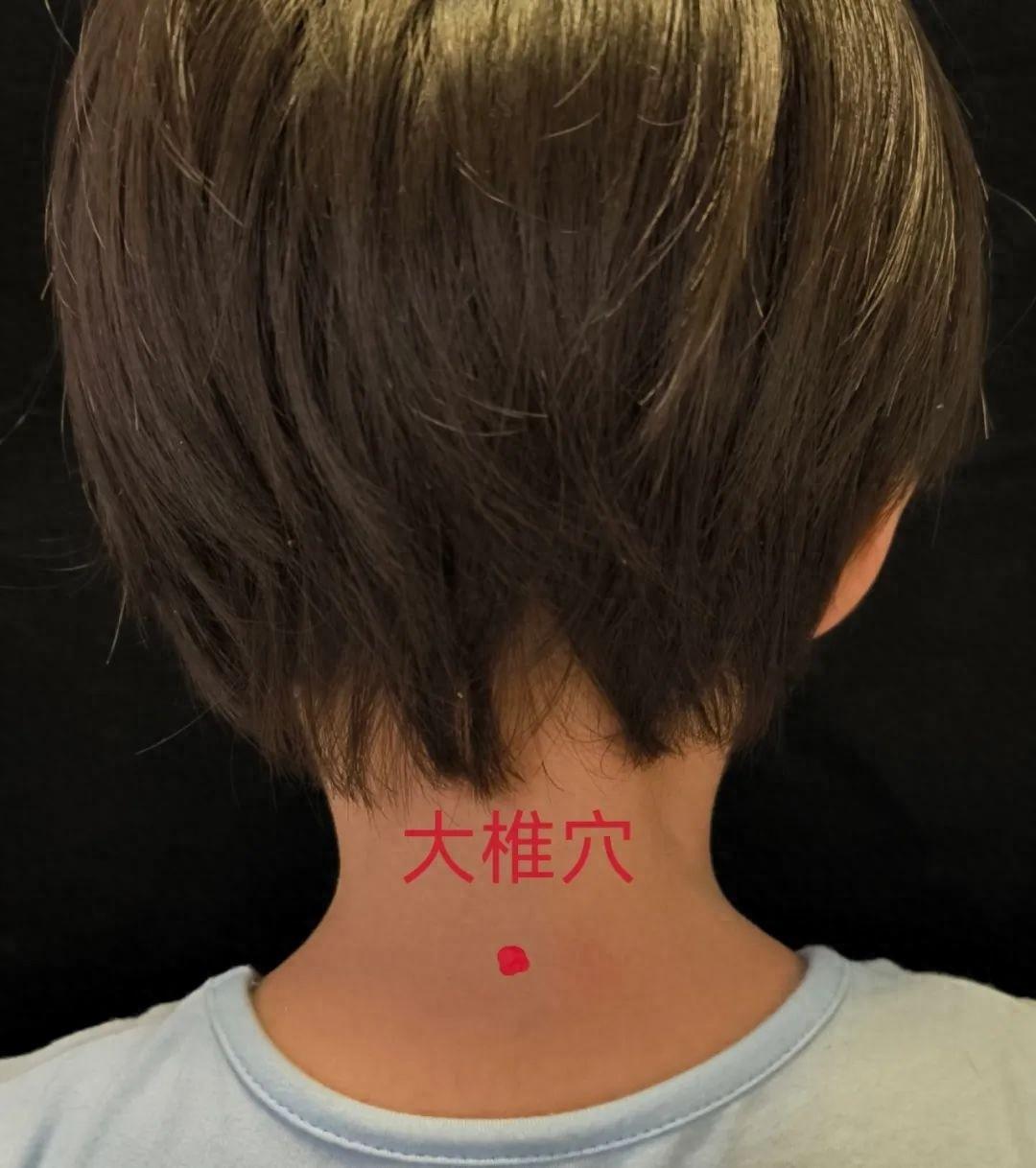 人体阳气的汇聚之地——大椎穴，你知道它的神奇功效吗？  第1张