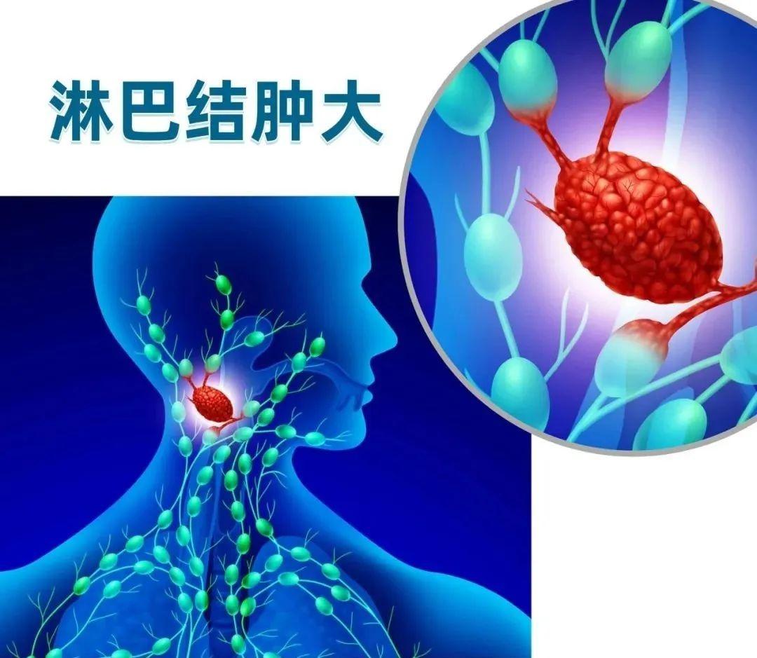 注意！打呼噜竟可能是血癌的信号，你还敢忽视吗？  第2张