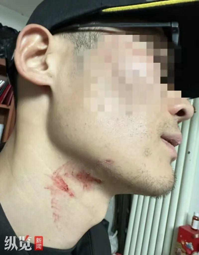 主播直播时竟遭男子木棍追打，原因不明  第1张