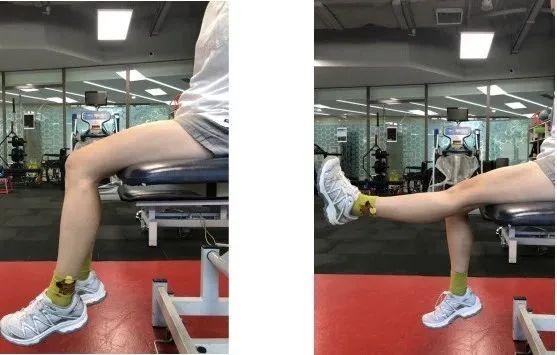 膝关节关节炎：了解它的成因与预防，远离关节疼痛  第4张